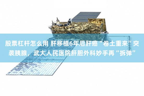 股票杠杆怎么用 肝移植6年后肝癌“卷土重来”突袭胰腺，武大人民医院肝胆外科妙手再“拆弹”
